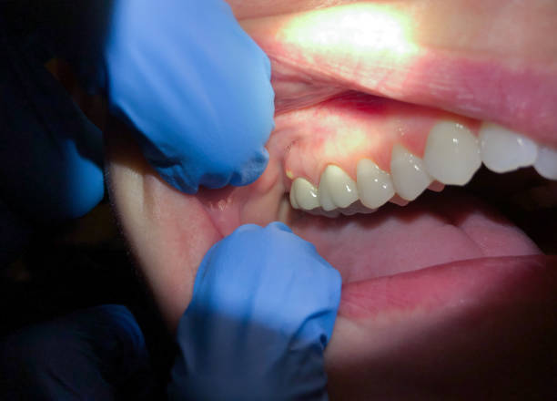 Best Cosmetic Emergency Dentistry in Greenacres, FL