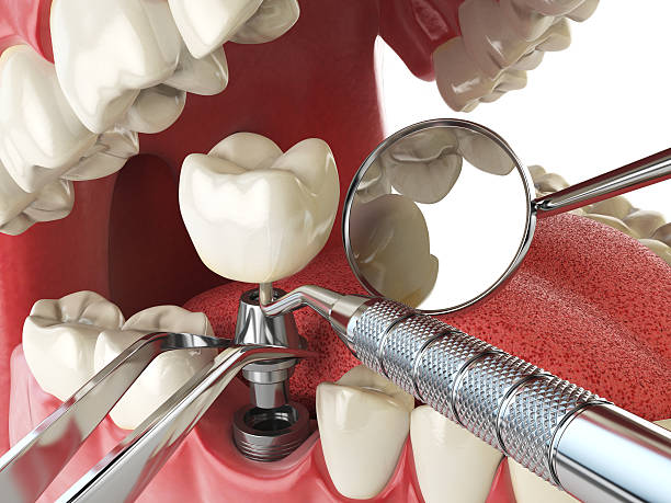 Best Emergency TMJ Treatment in Greenacres, FL